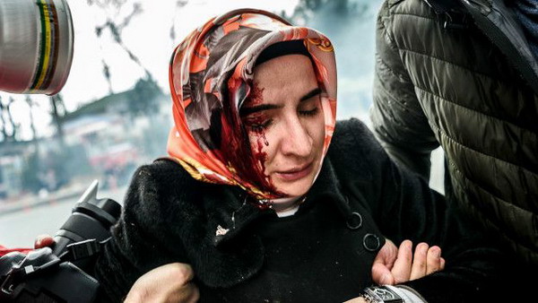 Турецкая полиция жестоко разогнала акцию протеста защитников ведущей оппозиционной газеты (ФОТО)