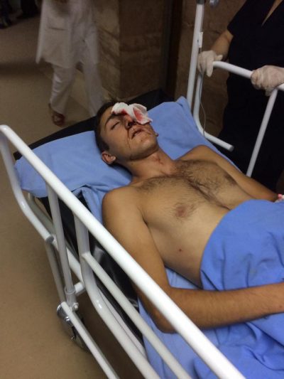 17-летнему Саяту Арутюняну удалили глаз вследствие травмы от полицейского спецсредства