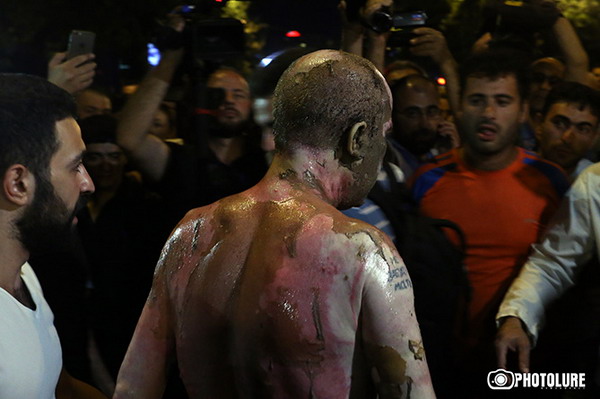 Совершивший в Ереване попытку самосожжения мужчина находится в крайне тяжелом состоянии: врачи