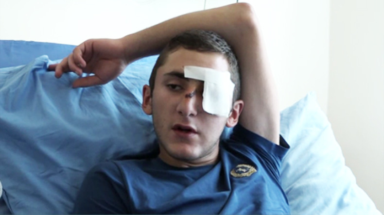 После захвата полка ППС в Ереване в больницах остаются 12 пострадавших: Минздрав