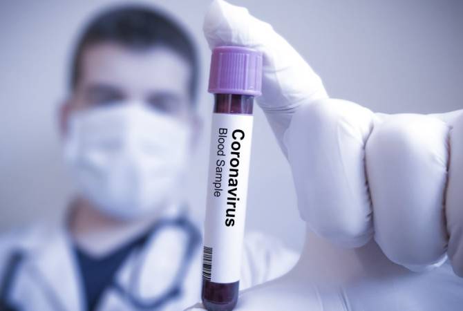 Шесть новых случаев коронавируса: общее число заразившихся в Армении — 78