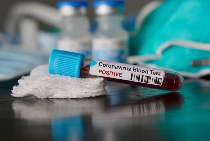 Из 136 случаев коронавируса 112 связаны со случаями в Эчмиадзине и на предприятии в Шенгавите