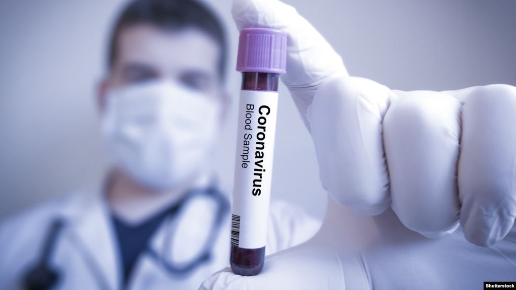 Минздрав Армении: новых случаев коронавируса — 24, общее число — 160, из них у 11 пневмония