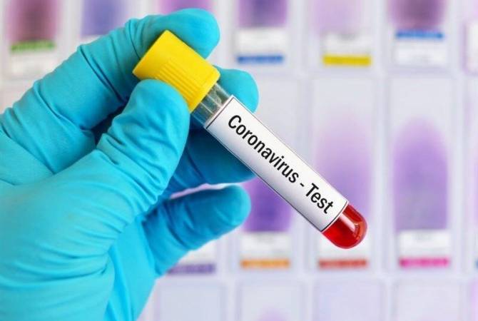 COVID-19: За сутки от коронавируса в Армении скончались 11 человек