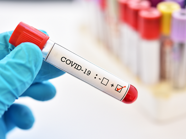 COVID-19: За сутки от коронавируса в Армении скончался один пациент