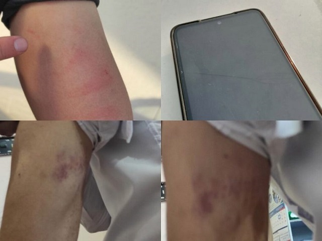 Группа репортеров из Узбекистана подверглась нападению во время репортажа в мэрии Андижана