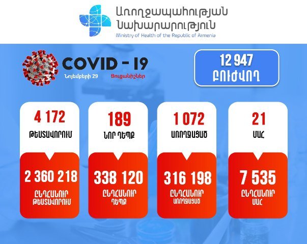 Подтверждено 189 новых случаев заболевания коронавирусом, зарегистрирован 21 смертельный случай