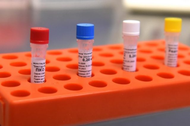 В Арцахе зарегистрировано 37 новых случаев заболевания коронавирусом, зафиксировано 3 случая смерти