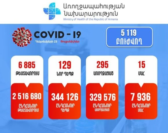 Подтверждено 129 новых случаев заболевания коронавирусом, зарегистрировано 15 летальных исходов